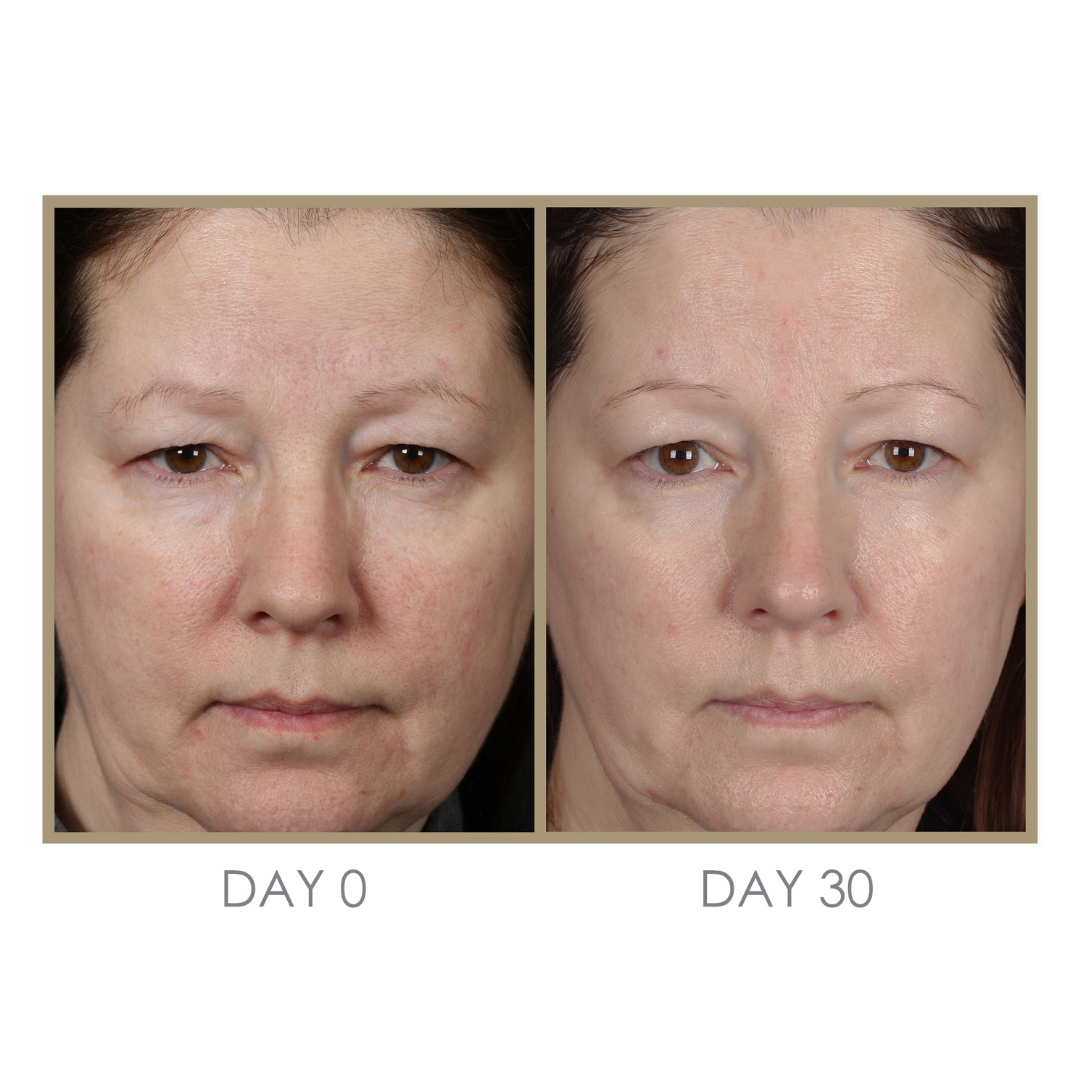 Dream Cream Moisturizing Treatment - PREORDER