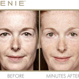 Instant Line Smoother Duo - PREORDER