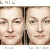 Instant Line Smoother Duo - PREORDER