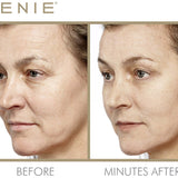 Instant Line Smoother Duo - PREORDER