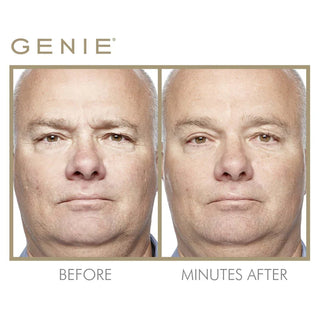 Genie Instant Line Smoother Holiday Deal 30 ml  - PREORDER