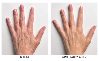 Genie Instant Hand Perfecter Duo  - PREORDER