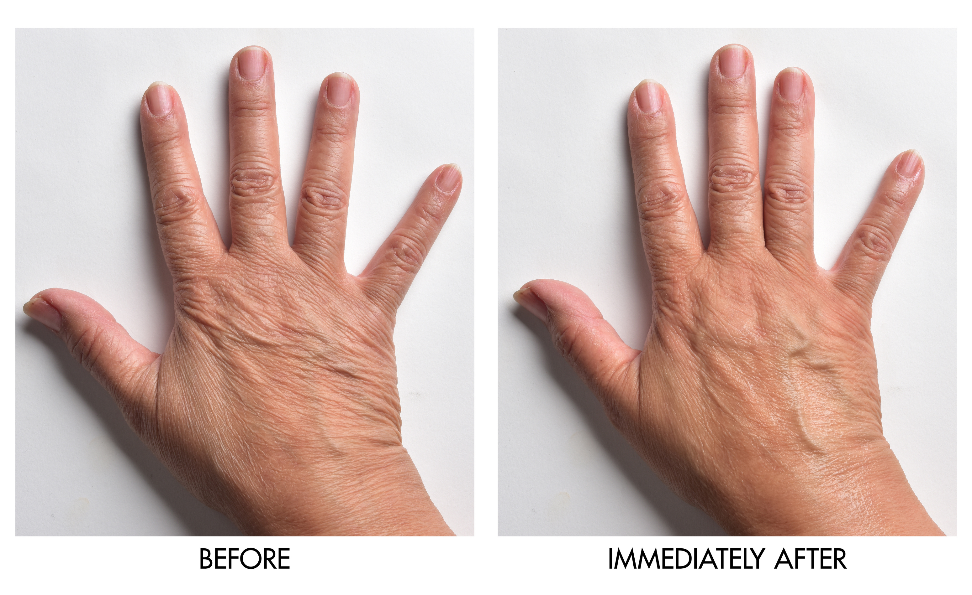 Genie Instant Hand Perfecter - PREORDER
